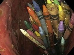 Ngeri! Deretan Gambar Medis Ini Bikin Merinding