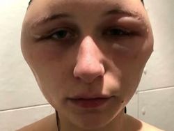 Ngeri! Deretan Gambar Medis Ini Bikin Merinding