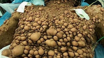 Ratusan tumor saraf yang membentuk benjolan lunak di/di bawah kulit! Foto: Boredpanda