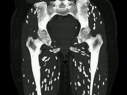 Ngeri! Deretan Gambar Medis Ini Bikin Merinding