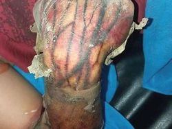 Ngeri! Deretan Gambar Medis Ini Bikin Merinding