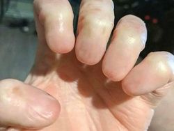 Ngeri! Deretan Gambar Medis Ini Bikin Merinding