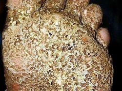 Ngeri! Deretan Gambar Medis Ini Bikin Merinding