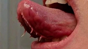 Plica fimbriata mengacu pada lipatan kecil pada selaput di bagian bawah lidah Anda. Lipatan-lipatan ini cenderung sejajar dengan, dan di kedua sisi frenulum Anda. Frenulum adalah jaringan ikat yang menghubungkan lidah Anda ke bagian bawah mulut Anda. Pertumbuhan ini tidak berbahaya. Ini adalah jaringan sisa normal yang tidak sepenuhnya diserap kembali oleh tubuh selama perkembangan dan pertumbuhan lidah. Foto: Boredpanda