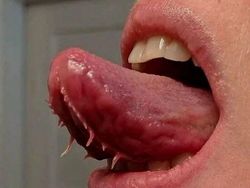 Ngeri! Deretan Gambar Medis Ini Bikin Merinding