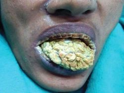 Ngeri! Deretan Gambar Medis Ini Bikin Merinding