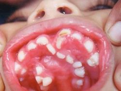 Ngeri! Deretan Gambar Medis Ini Bikin Merinding