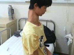 Ngeri! Deretan Gambar Medis Ini Bikin Merinding