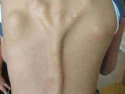 Ngeri! Deretan Gambar Medis Ini Bikin Merinding