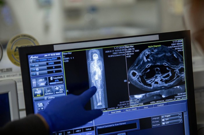 Mumi Mesir kuno Nes-Hor tertangkap layar selama pemindaian CT seluruh tubuh oleh ahli radiologi Keck Medicine of USC dari AS