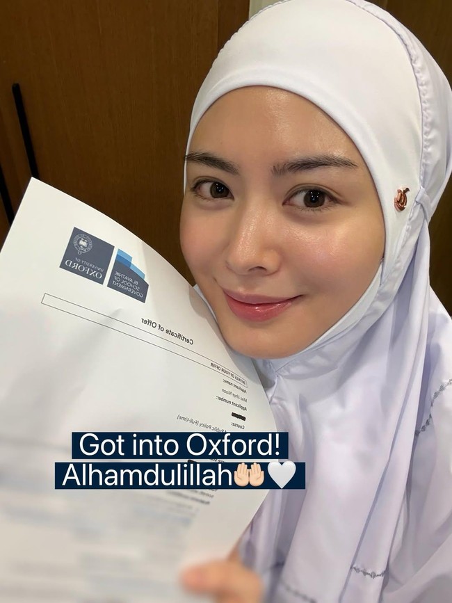 Keren! Ayana Moon Ditawari S2 di Universitas Oxford
