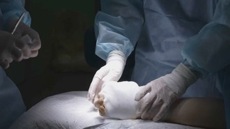 Video Rusia Sukses Lakukan Cangkok Tangan untuk Pertama Kalinya!