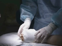 Video Rusia Sukses Lakukan Cangkok Tangan untuk Pertama Kalinya!