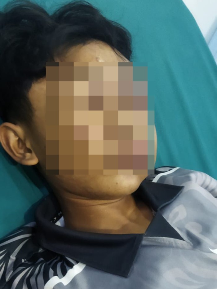 Santri di Kubu Raya lebam pada wajah dan belum sadarkan diri