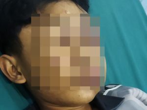 Santri di Kubu Raya Diduga Alami Kekerasan, Wajah Lebam dan Belum Sadar