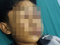 Keluarga Santri Lebam-lebam di Kubu Raya Lapor Polisi, Tunggu Hasil Visum