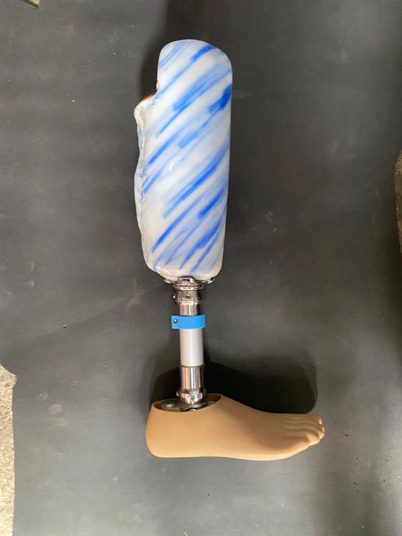 Mahasiswa UB Ciptakan Prostetik dari Limbah Plastik, Juara di Turki