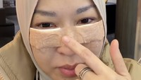 Namun, Okie mengaku awalnya takut melakukan operasi seperti itu. Dia juga sempat mendapat tawaran untuk melakukan pengencangan kulit wajah. Foto: Instagram @okieagustina_