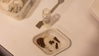Botol Obat Kuno di Turki Ungkap Praktik Medis Roma