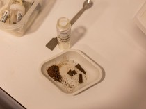 Botol Obat Kuno di Turki Ungkap Praktik Medis Roma