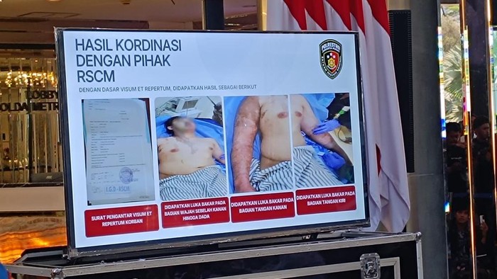 Polda Metro Jaya gelar konferensi pers update kasus penyiraman air keras ke aktivis KontraS Andrie Yunus (Rizky/detikcom)