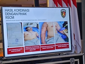 Video: Komisi III DPR Minta Kemenkes Tanggung Biaya Pengobatan Andrie Yunus