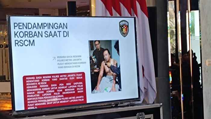 Polda Metro Jaya gelar konferensi pers update kasus penyiraman air keras ke aktivis KontraS Andrie Yunus (Rizky/detikcom)