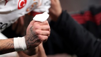 Cedera Horor Noa Lang, Jari Nyaris Putus Terjepit Papan Iklan Anfield