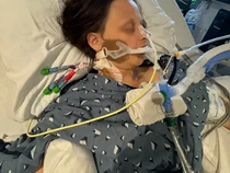 Ngeri! Usai Makan Ikan Fermentasi, Wanita Ini Nyaris Tewas