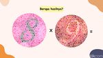 Tes IQ Sekaligus Cek Kondisi Mata, Bisa Tebak Hasilnya Berapa?