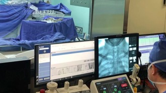 Robot China Ungguli Dokter Bedah Otak, Pangkas Waktu 29%