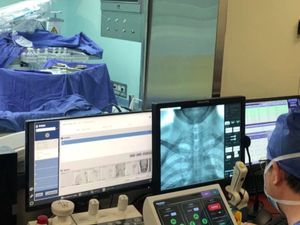 Robot China Ungguli Dokter Bedah Otak, Pangkas Waktu 29%