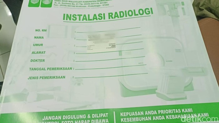 Hasil CT-Scan murid dibanting guru ngaji