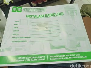CT-Scan Ungkap Bekas Perdarahan Murid Dibanting Guru Ngaji Probolinggo
