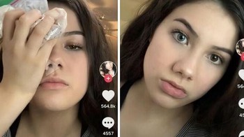 Influencer ini bilang ke anak-anak di TikTok kalau pakai pemutih pakaian ke mata mereka bisa mengubah warna mata. Kan sesat. Foto: skyethefemboy via Bored Panda