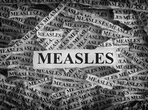 Kaitkan Campak dengan Provokasi Antivaksin, Kemenkes Laporkan Konten Penebar Hoax!