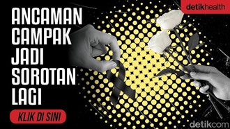 Dokter Muda di Cianjur Meninggal Diduga Campak, Pakar Soroti Komplikasi Pneumonia