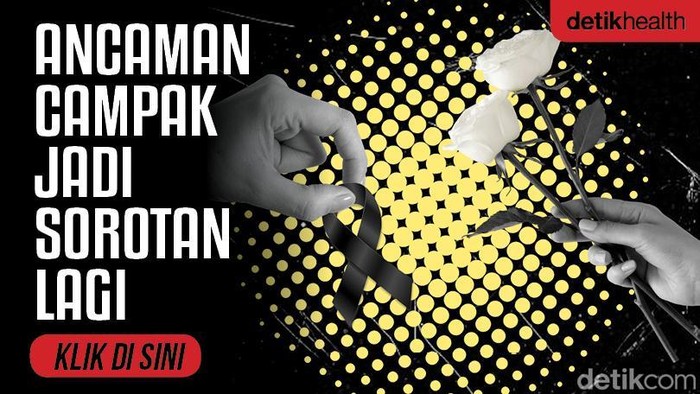Ilustrasi campak