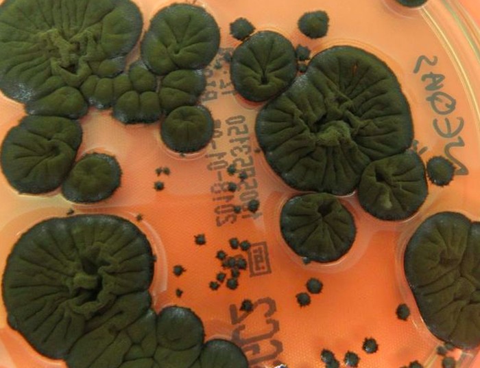 C. sphaerospermum yang mengalami melanisasi.