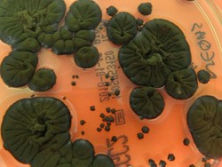 Radiasi Chernobyl Bikin Jamur Punya Kemampuan Super