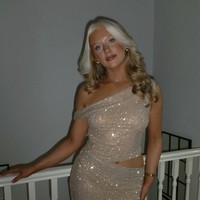 Rambut Putih Bukan karena Usia, Ini Kisah Wanita dengan Kondisi Genetik Langka