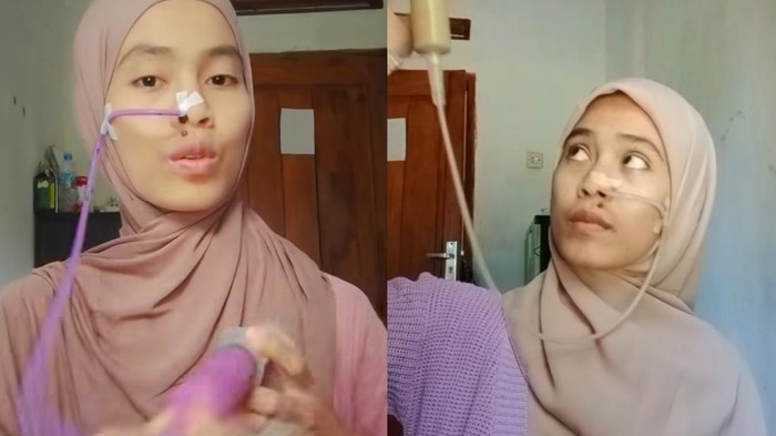 Kisah perempuan makan lewat selang.