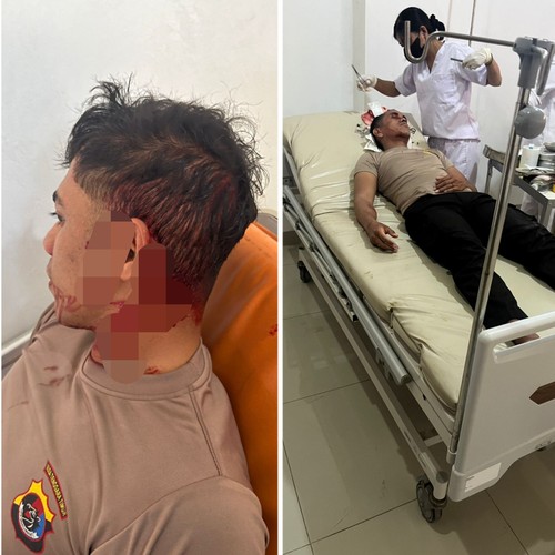 dua anggota Polres Rote Ndao, NTT, saat menjalani perawatan medis di RSUD Baa akibat kena lemparan batu di bagian kepala, Senin (30/3/2026). (Dok. Polres Rote Ndao).