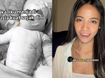 Viral Cerita Wanita Bali Jalani Transplantasi Kulit usai Alami Luka Bakar 85 Persen