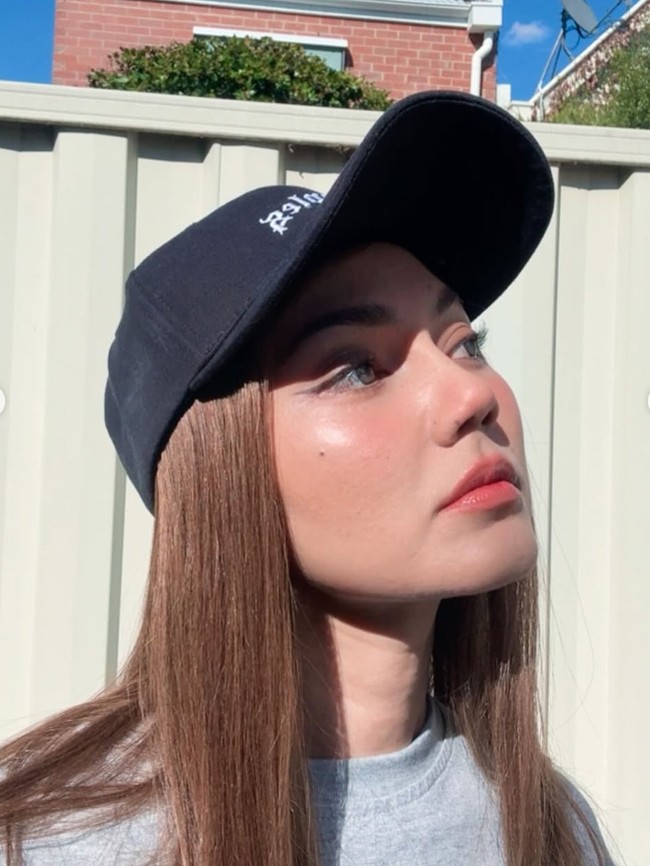 Potret Rina Nose Liburan ke Melbourne Bareng Suami, Memukau Usai Oplas Hidung