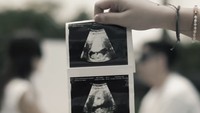 Keduanya menutup mata dan semula mengunggah video hitam dan putih. Foto: Instagram @adindathomas