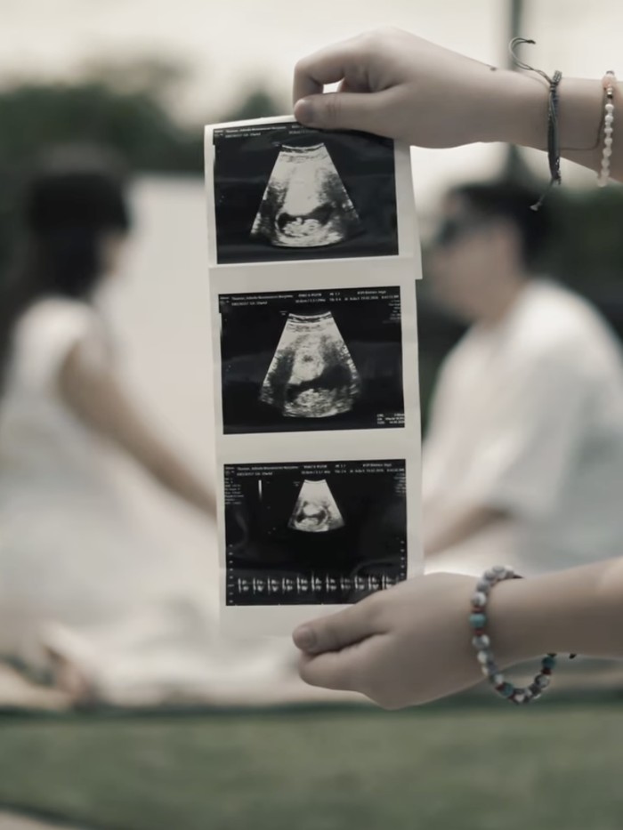Adinda Thomas gelar gender reveal.