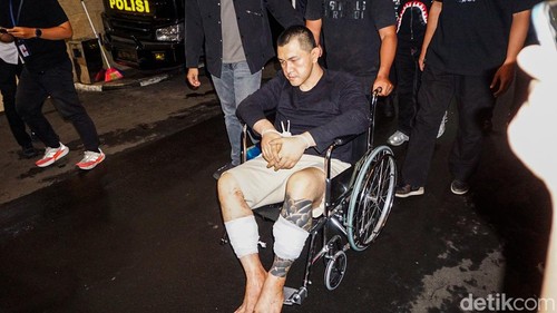 Andre Fernando alias ‘The Doctor’ tiba di Mabes Polri sekitar pukul 19.25 WIB, Senin (6/4/2026). Buron bandar narkoba tersebut tiba menggunakan kursi roda dengan kedua kaki diperban dan kedua tangan terikat.