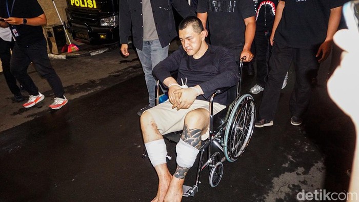 Andre Fernando alias The Doctor tiba di Mabes Polri sekitar pukul 19.25 WIB, Senin (6/4/2026). Buron bandar narkoba tersebut tiba menggunakan kursi roda dengan kedua kaki diperban dan kedua tangan terikat.