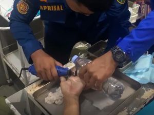 Jari Wanita Lansia di Barru Melepuh-Terjepit Cincin, Damkar Evakuasi di RS